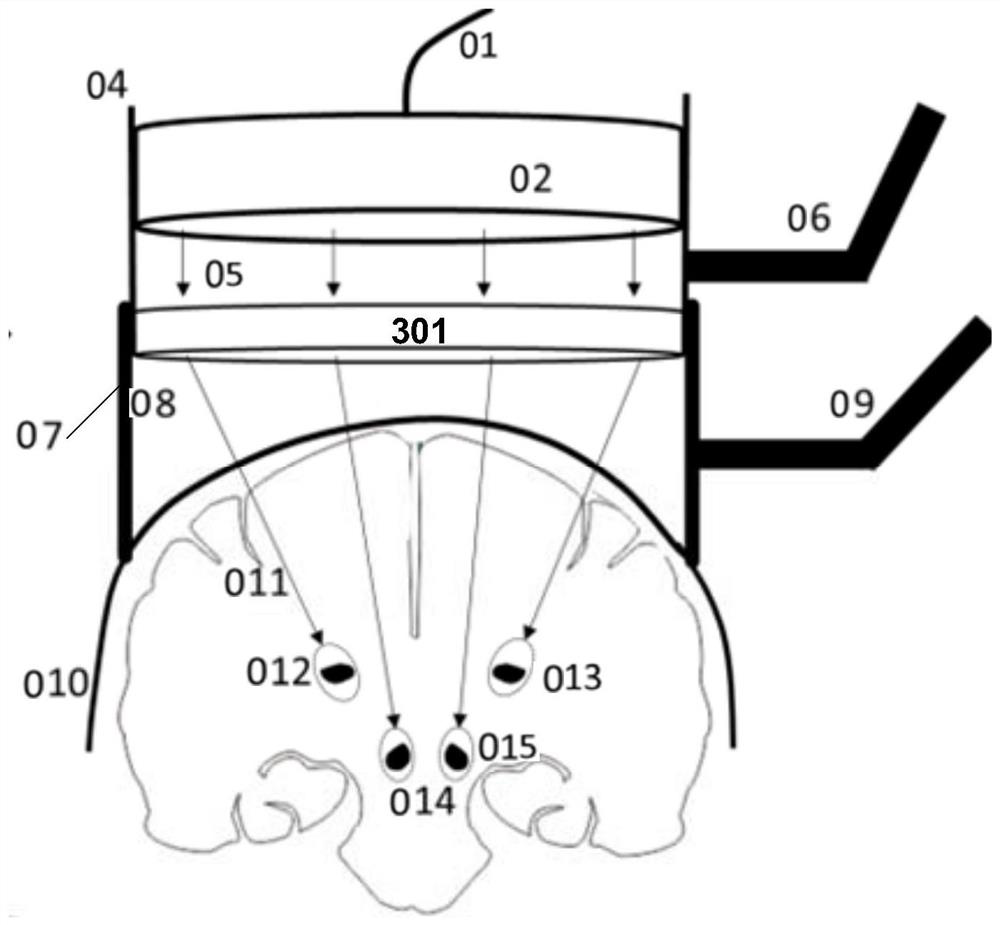 a neuroregulatory device