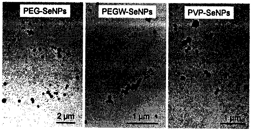 Application of nano-selenium as radiosensitizer of iodine‑125 particles