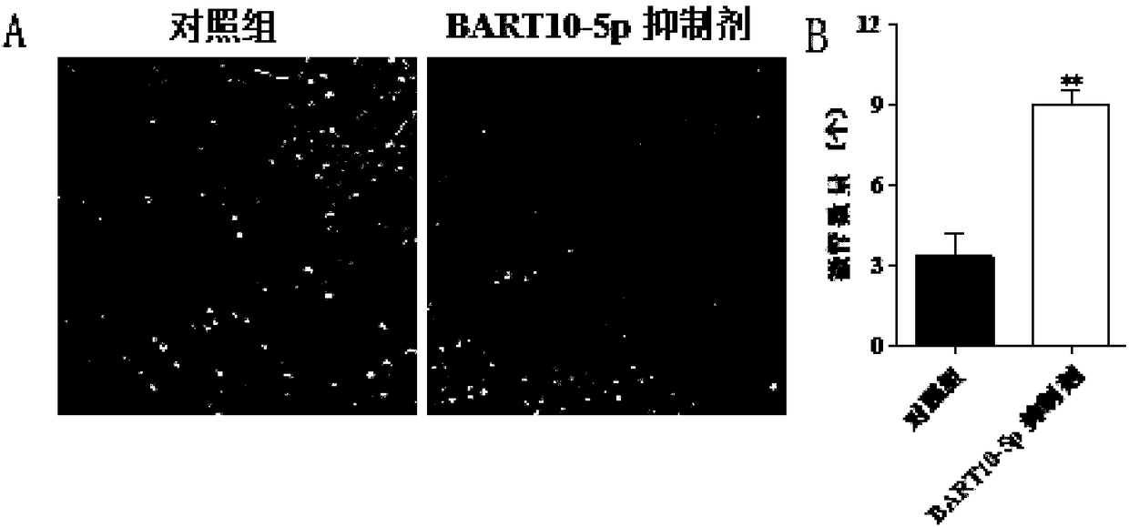 Applications of EB virus miR-BART10-5p inhibitor