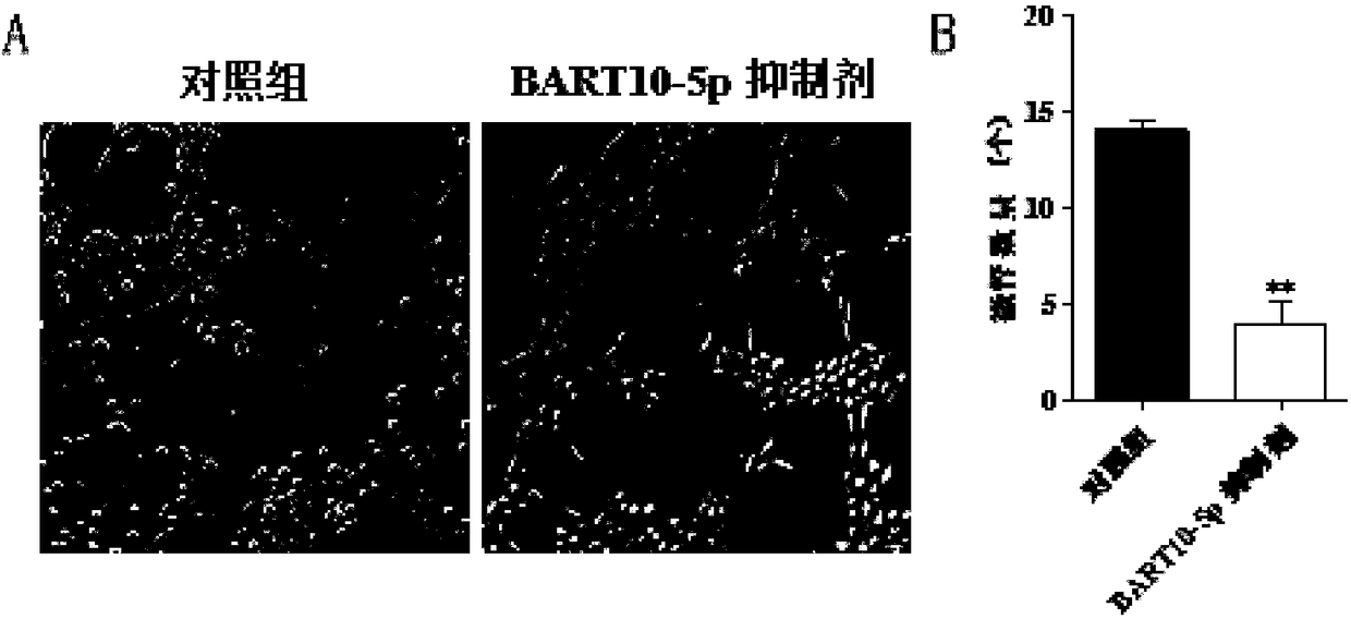 Applications of EB virus miR-BART10-5p inhibitor