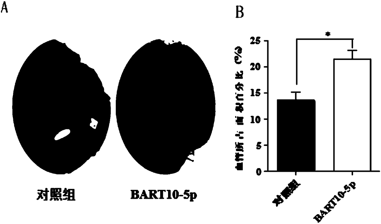 Applications of EB virus miR-BART10-5p inhibitor