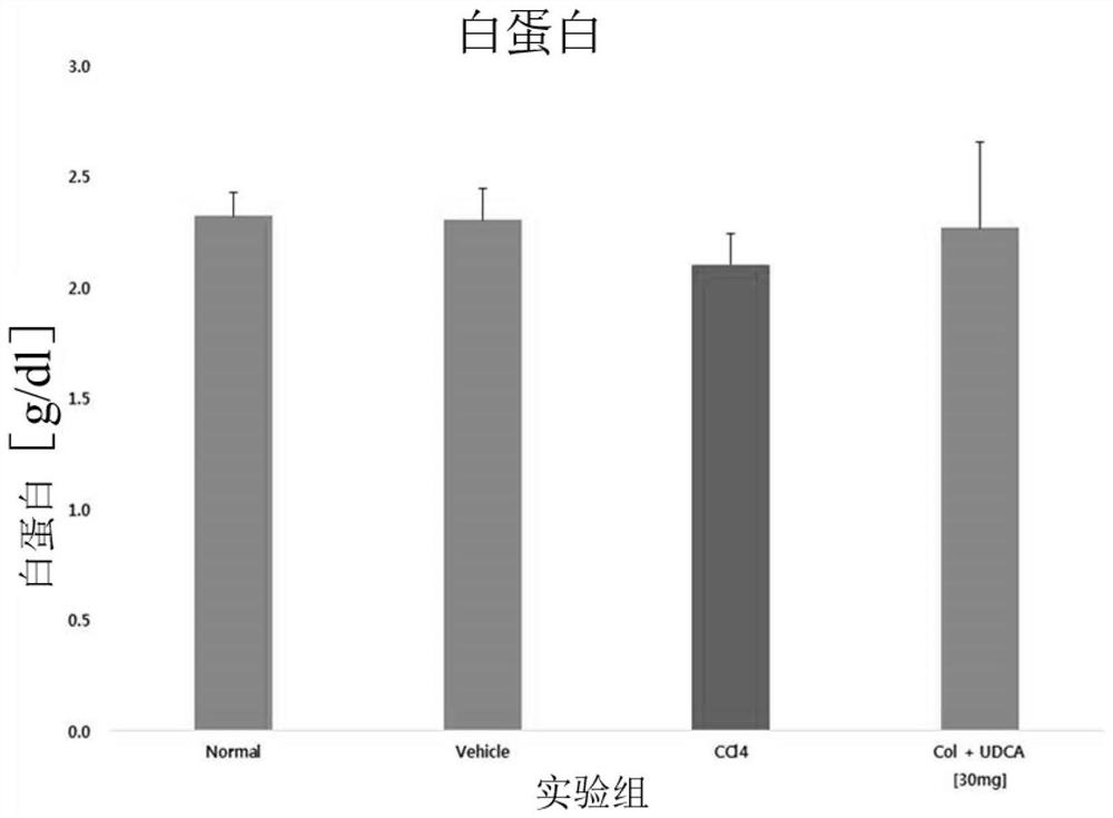 Combination formulation containing colchicine for treatment or enhancing the therapy of liver disease