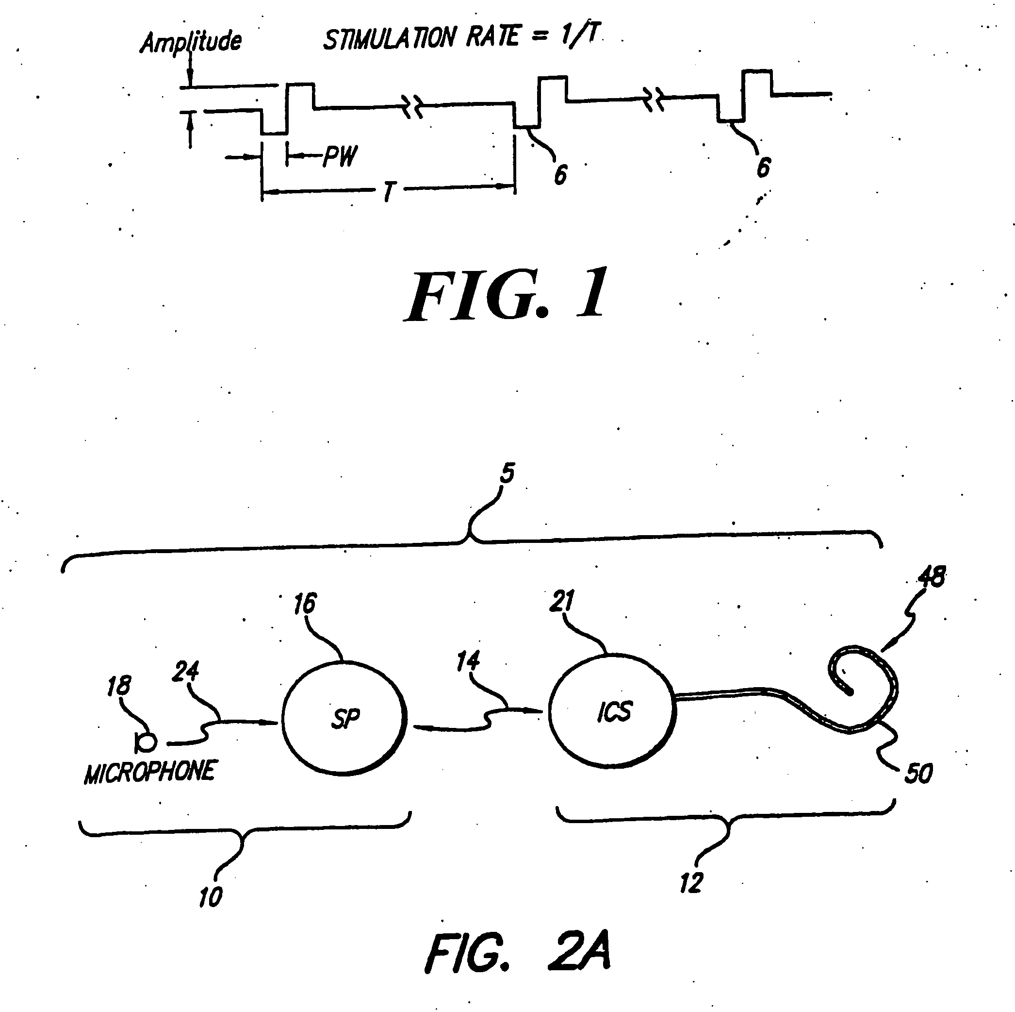 Cochlear implant with localized fluid transport