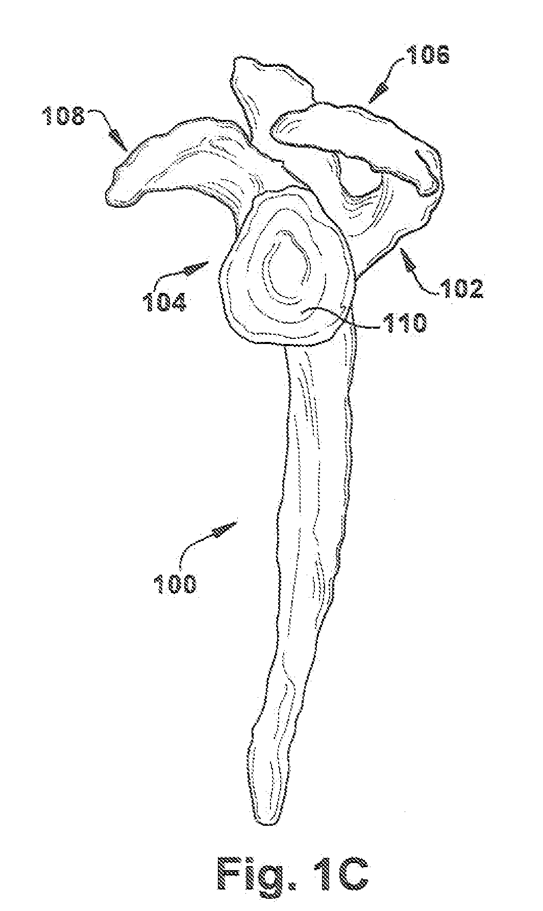 Method and apparatus for preparing for a surgical procedure