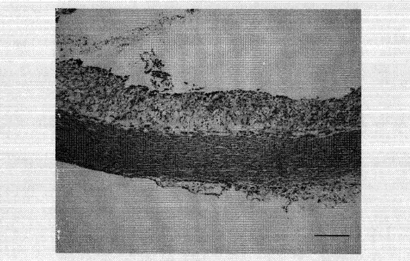 Drug combination containing raloxifene and application thereof