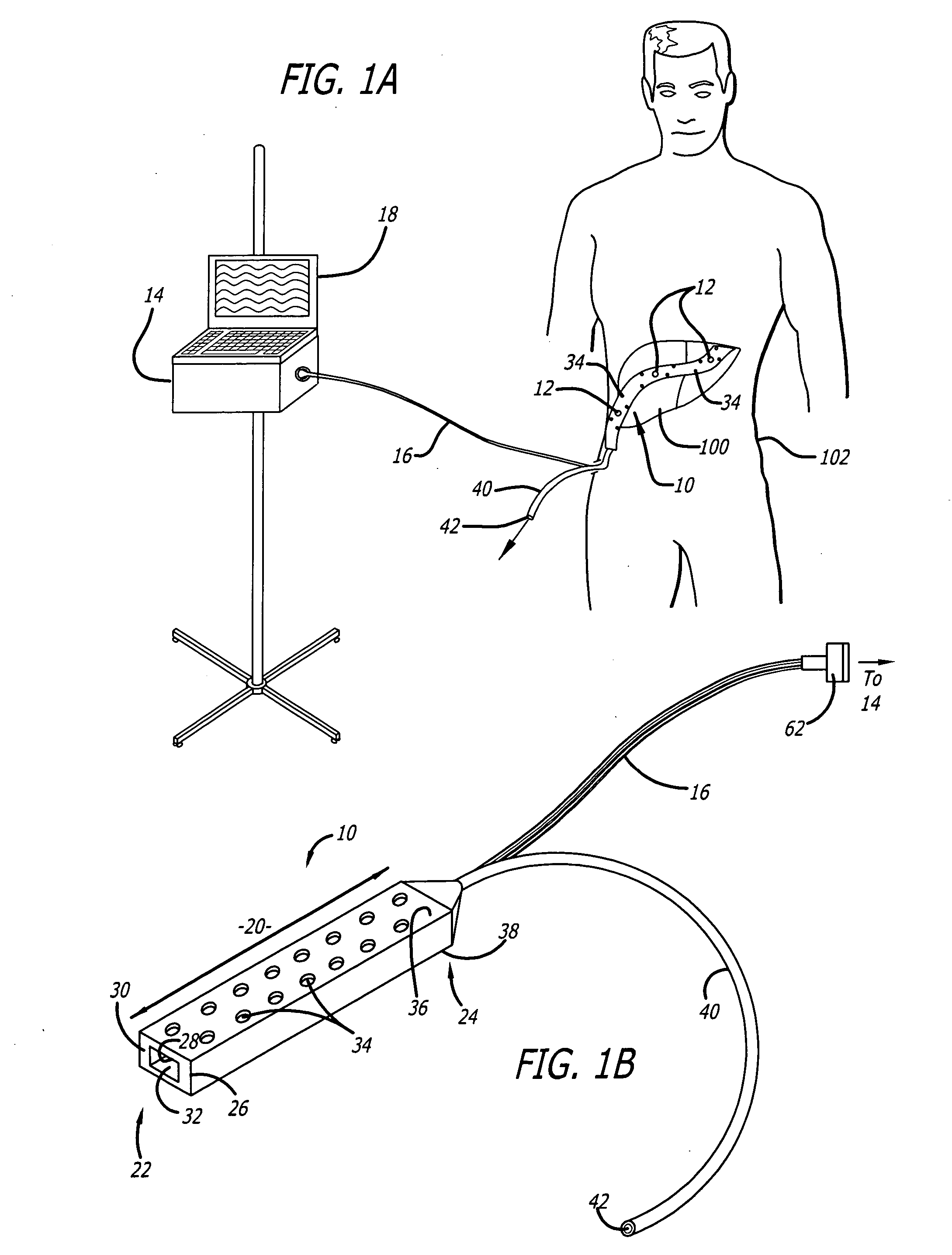 Surgical drain with sensors for monitoring internal tissue condition