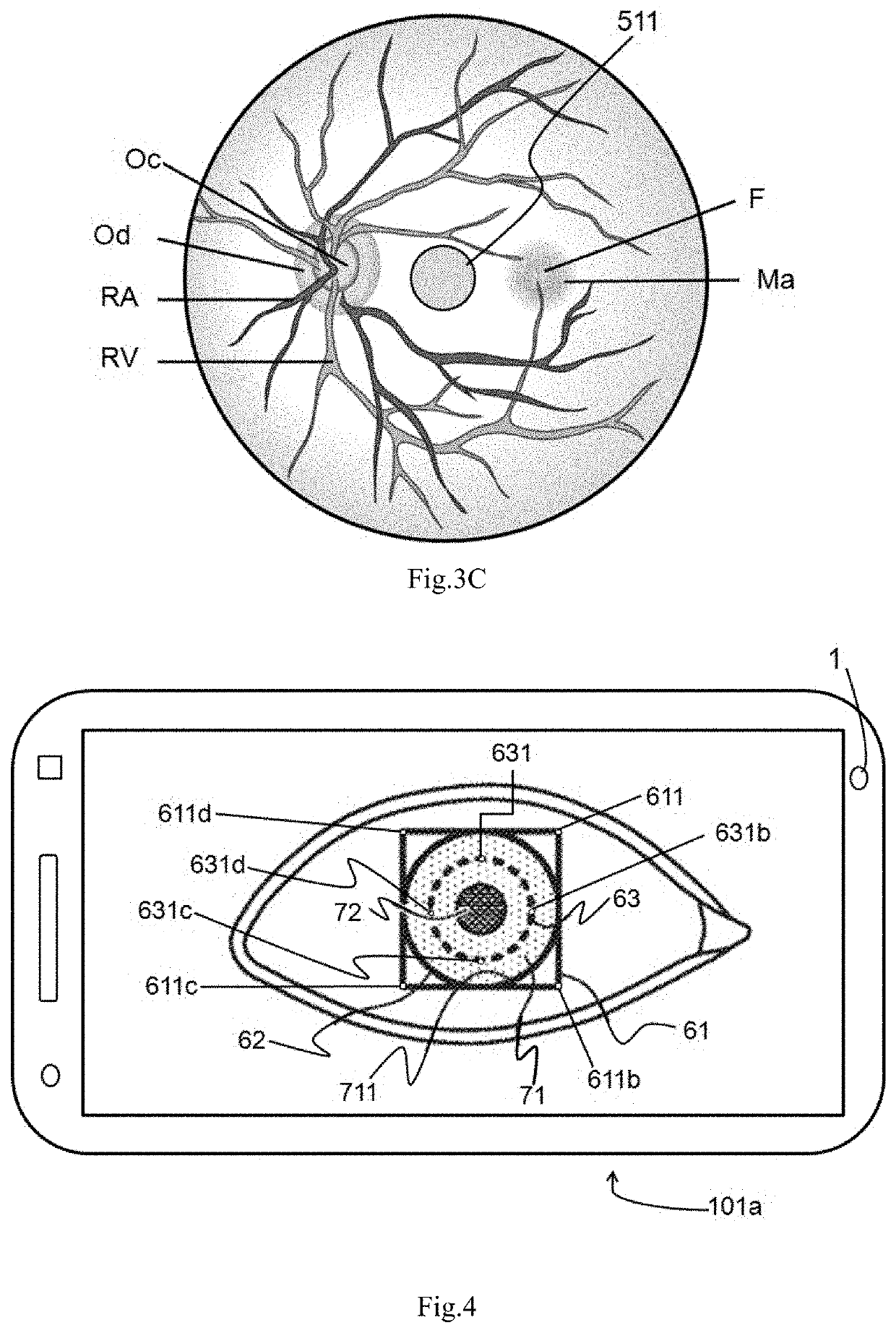 Method for standardized ophthalmic fundus imaging for the longitudinal monitoring of patients with eye diseases