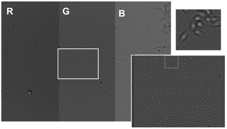 Lensless microscopic imaging system and image reconstruction method based on average projection iteration