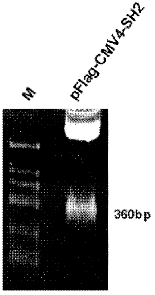 Recombination ubiquitin ligase SH2-U-box fusion gene as well as expression vectors and applications thereof