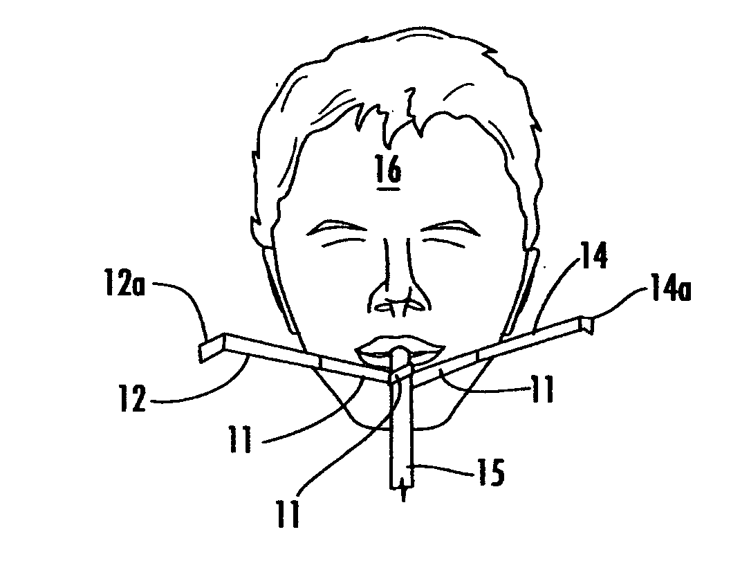 Apparatus for securing a tracheal tube or the like to a patient
