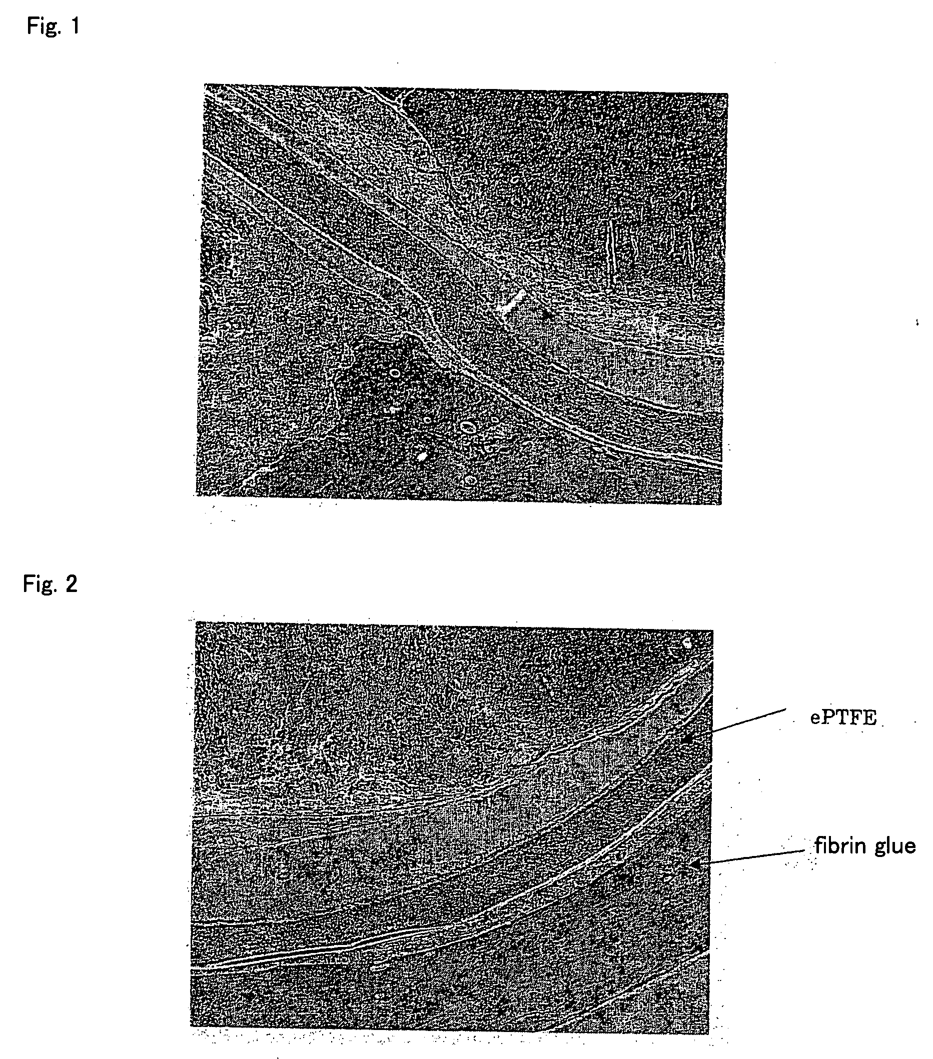 Biological repair material compatible with biological tissue adhesive