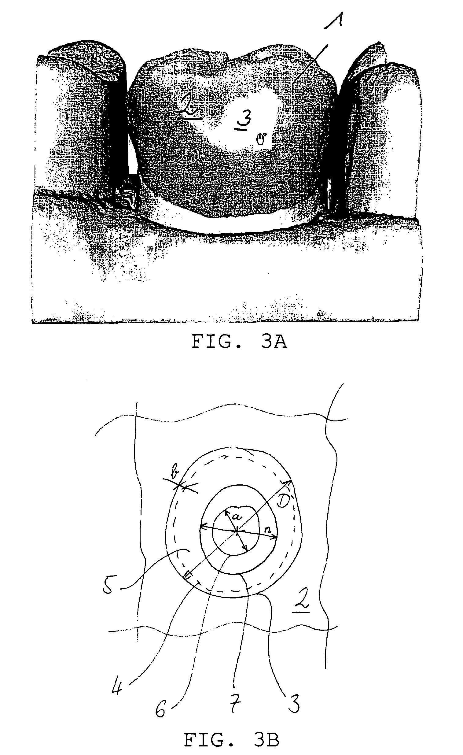 Method of processing a digitized workpiece, particularly a three-dimensional model of a dental prosthetic item to be produced therefrom, and apparatus therefor