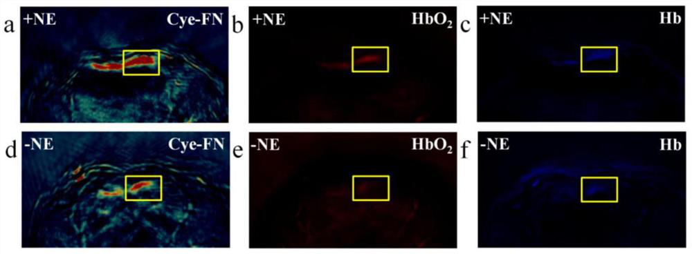 A contrast agent and its application in photoacoustic imaging of brown fat