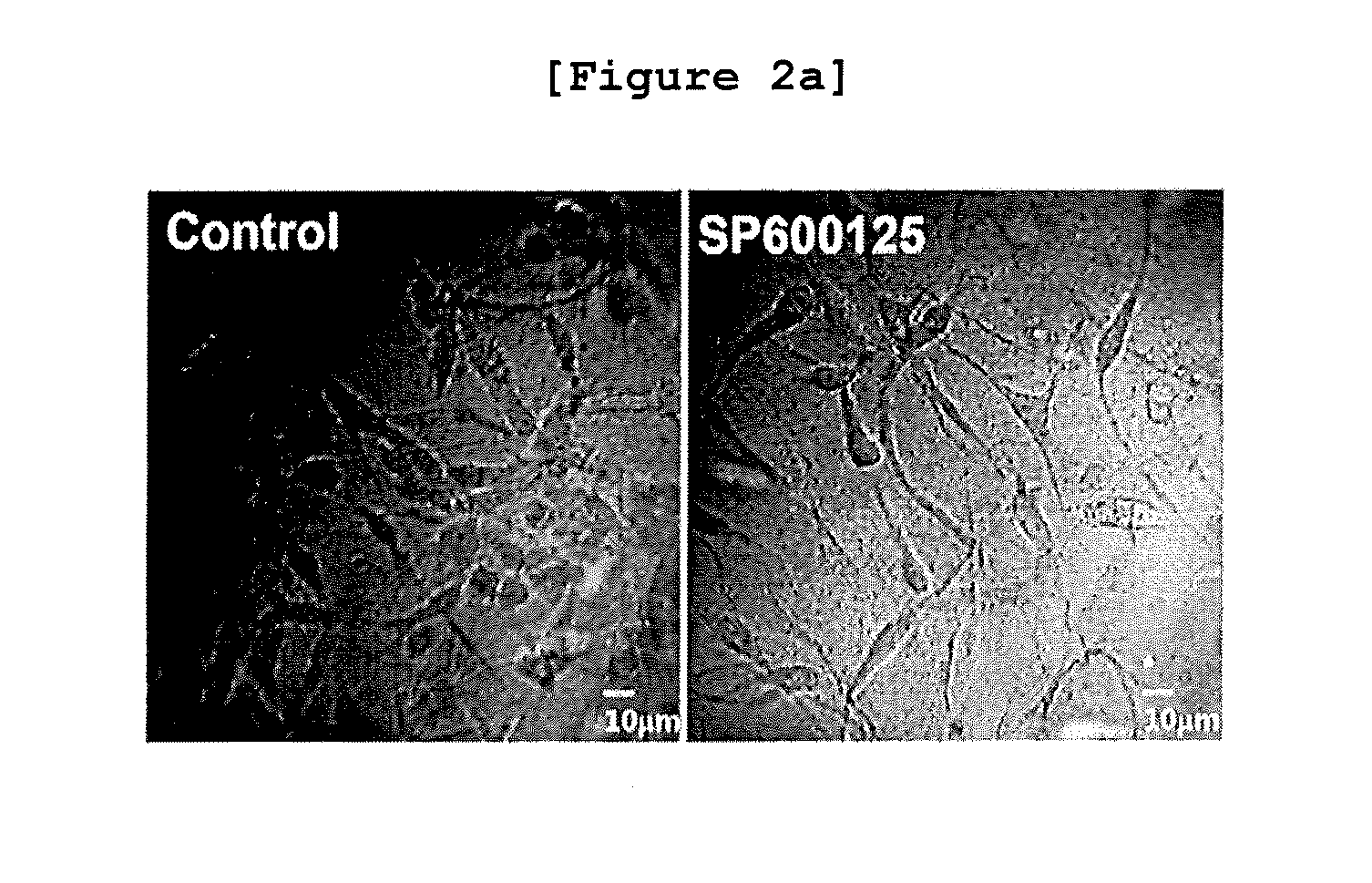 Method for monitoring metastasis of cancer cells using cells cultured in three dimensional collagen environment