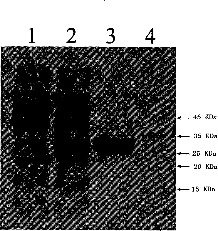 Genetic engineering target glioma Acp-W1 resistant protein, preparation method and application