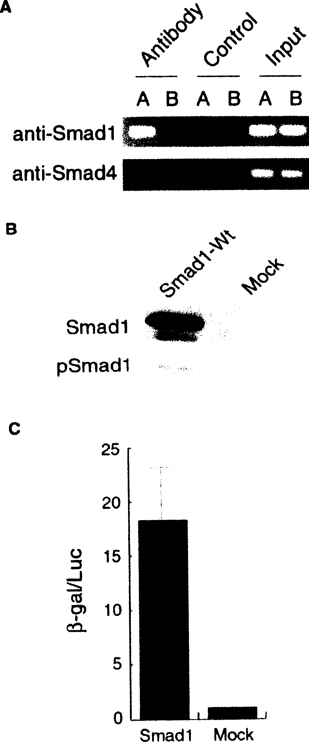 Method and kit for detecting proliferative diseases causing sclerosis, preventive and/or remedy for proliferative diseases causing sclerosis and method and kit for identifying substance efficacious in