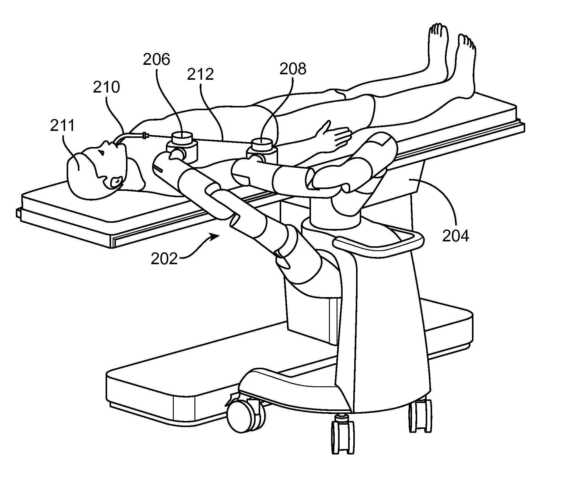 Endoscopic device with double-helical lumen design