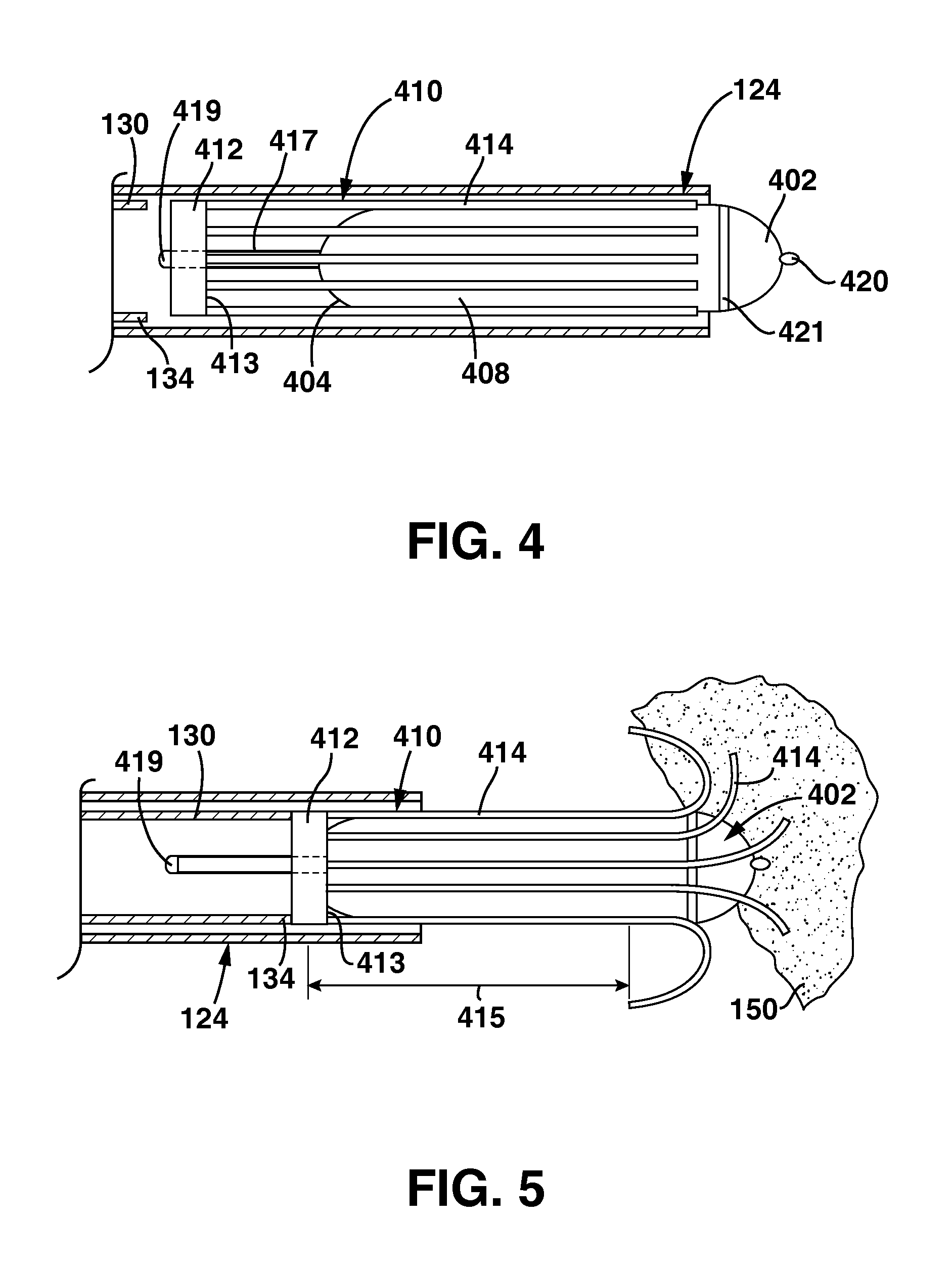 Slidable Fixation Device for Securing a Medical Implant
