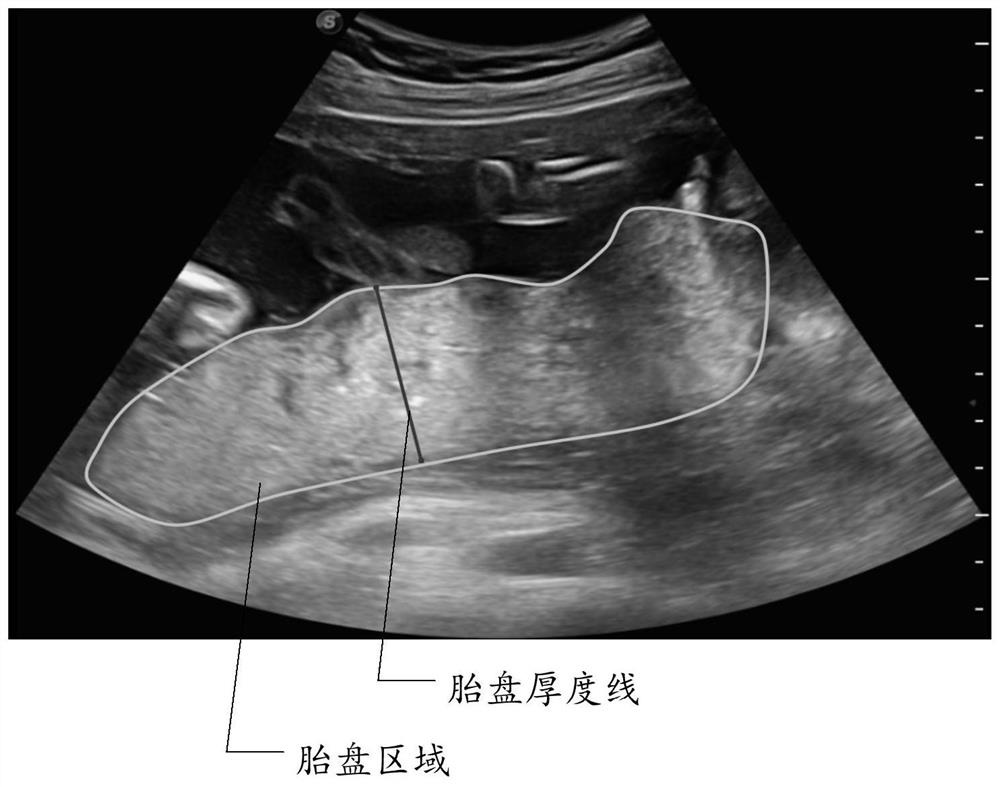 Placenta thickness determination method, device and equipment and storage medium
