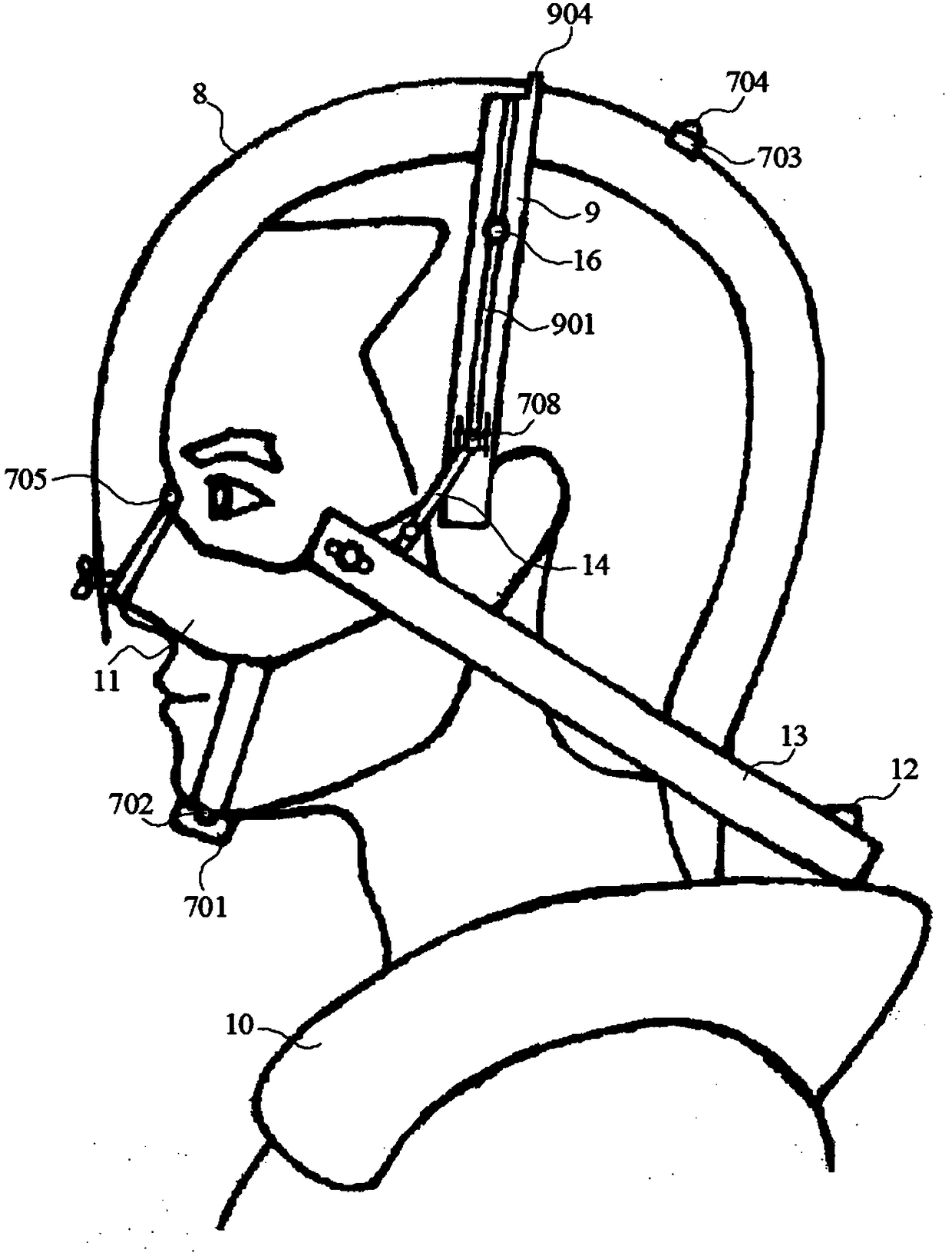 Method and device for three-dimensionally positioning heads of human bodies and modeling scalp states