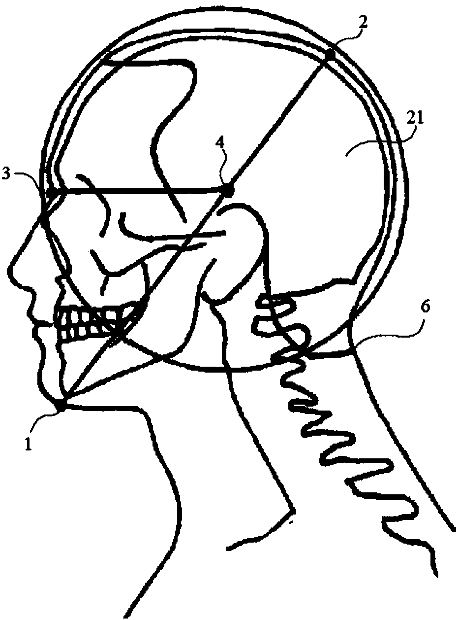 Method and device for three-dimensionally positioning heads of human bodies and modeling scalp states