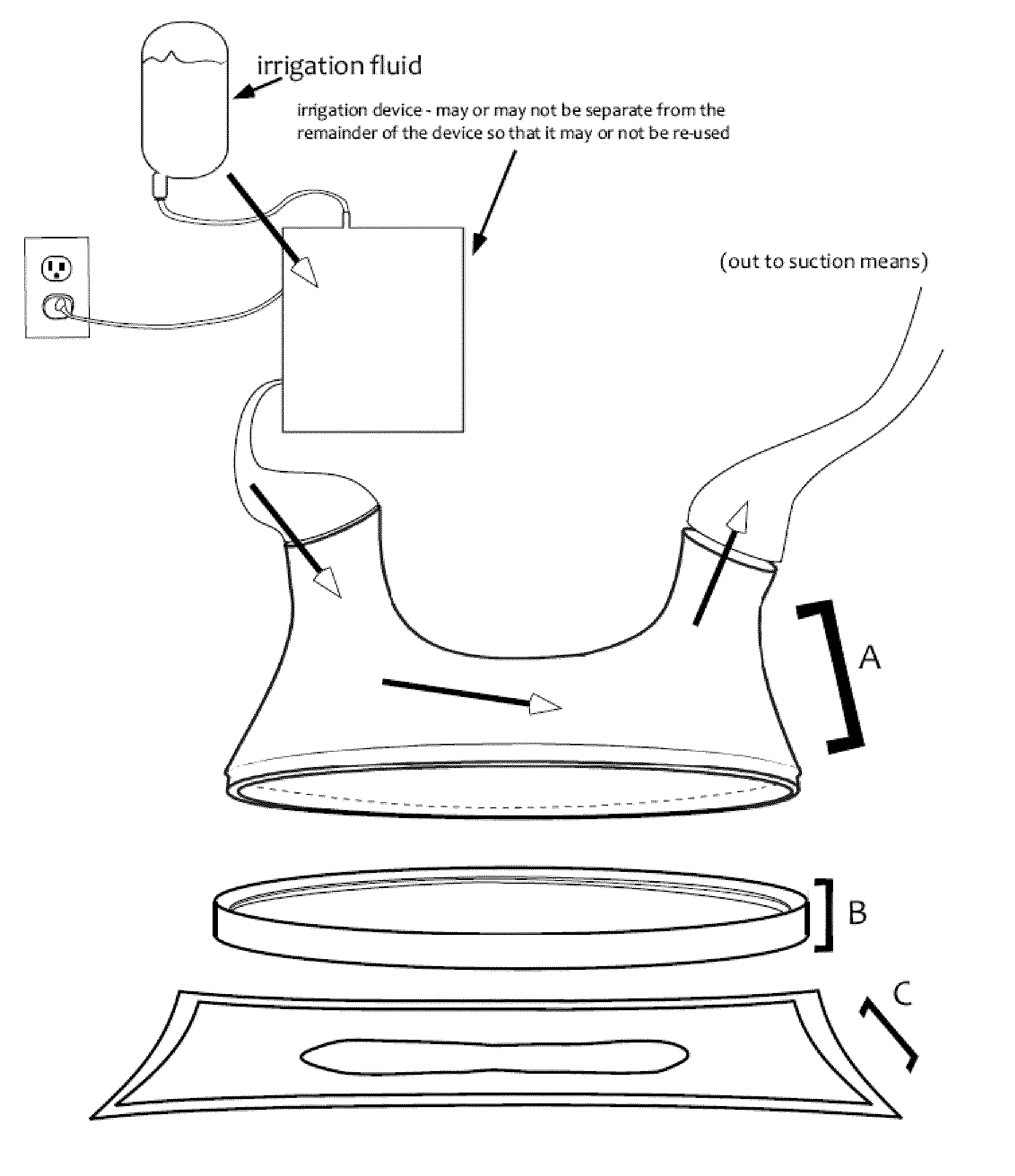 Wound treatment containment apparatus