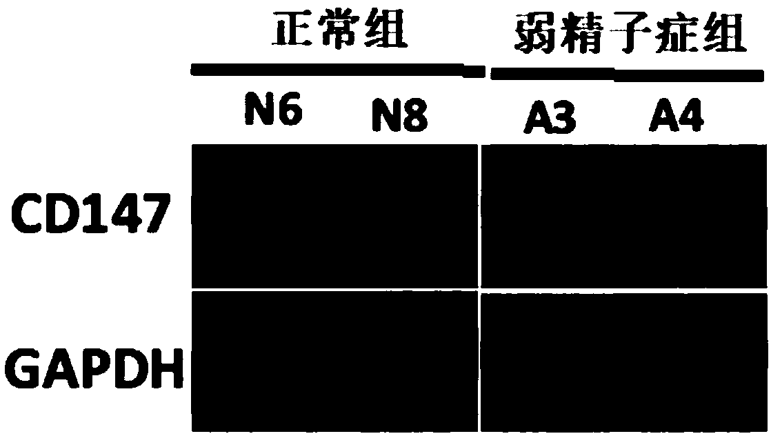 Use of human CD147