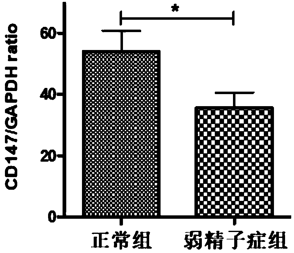 Use of human CD147