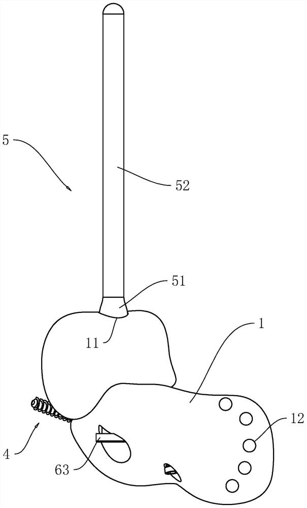 Calcaneus and talus prosthesis