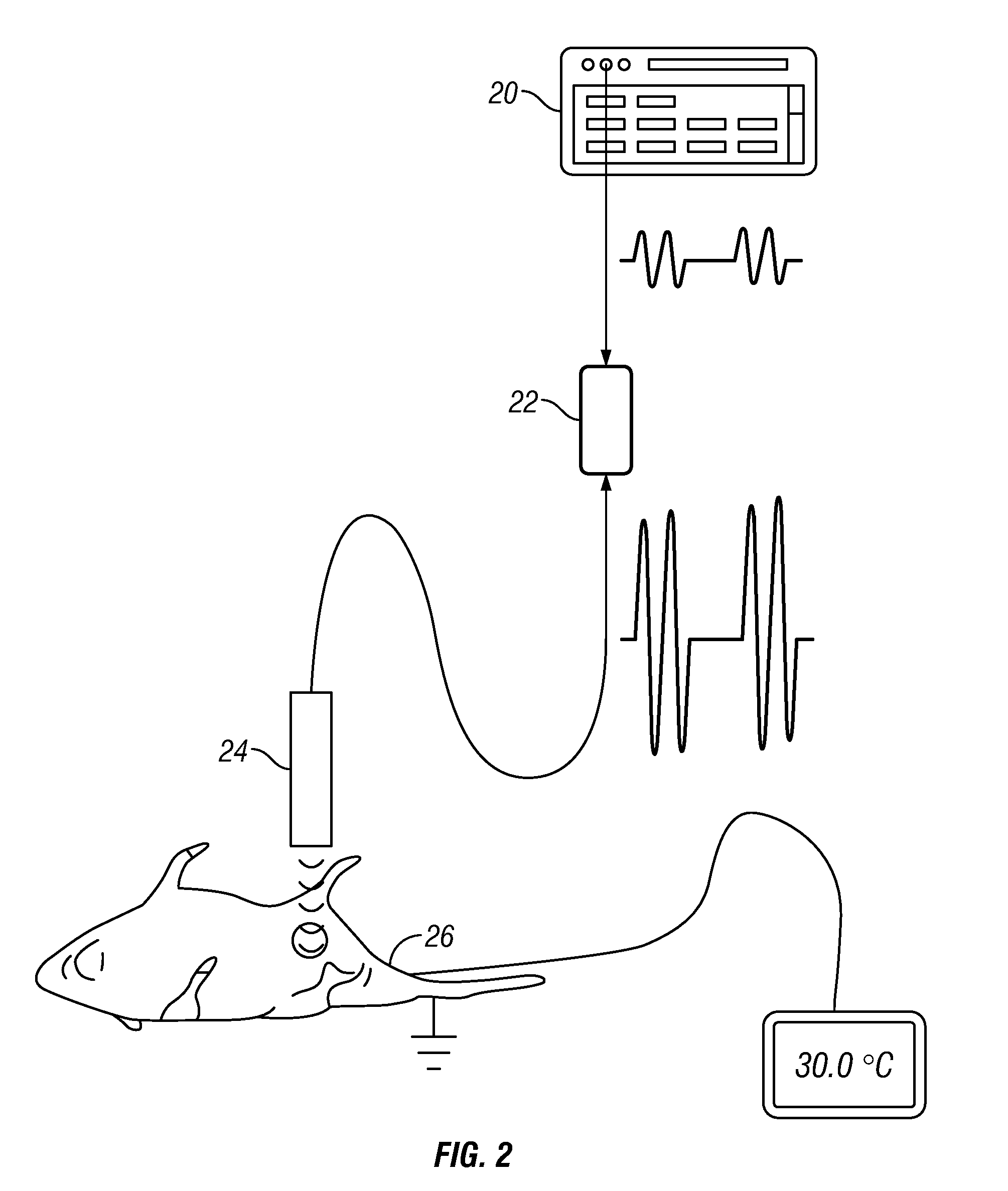 Methods and Apparatus for Treating a Cervix with Ultrasound Energy