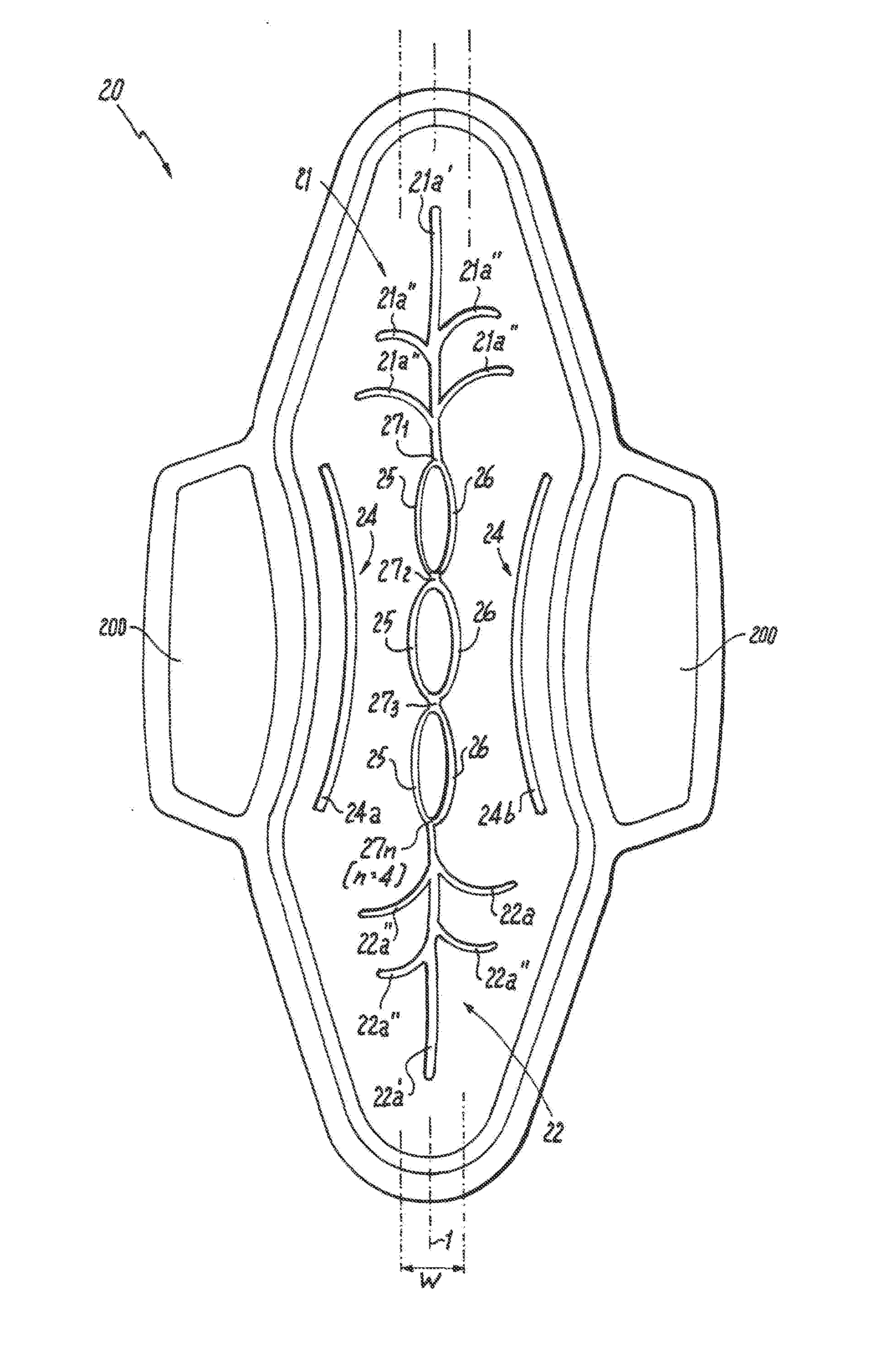 Absorbent article demonstrating controlled deformation and longitudinal fluid distribution