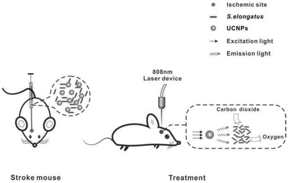 Treatment liquid for treating cerebral arterial thrombosis and preparation method and application thereof