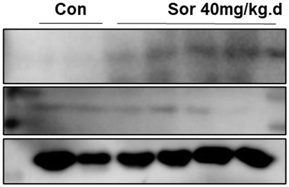 Medical application of CREG1 protein in prevention or treatment of sorafenib-induced myocardial injury