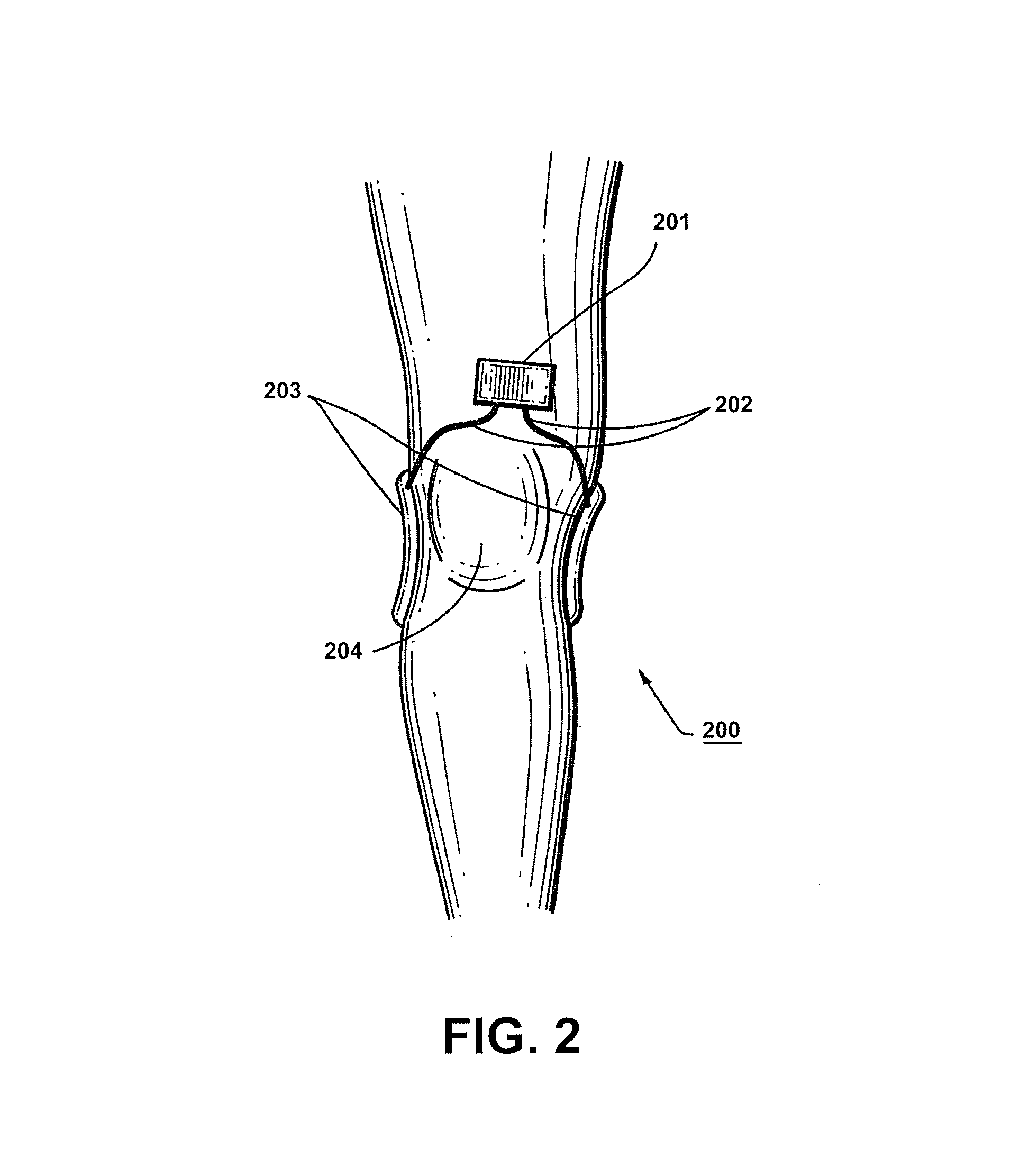 Apparatus and method for electromagnetic treatment of neurodegenerative conditions