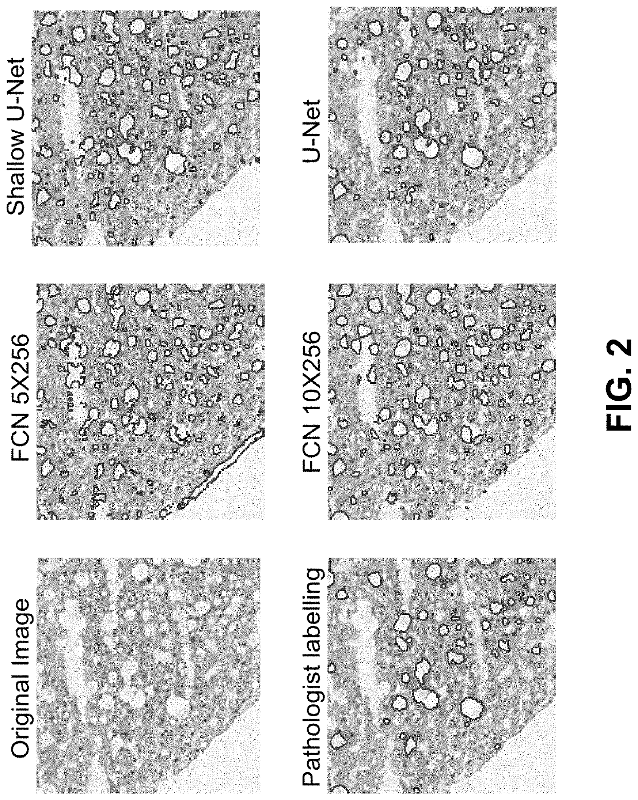 Quantification of Liver Steatosis from a biopsy using a Computer Imaging Platform