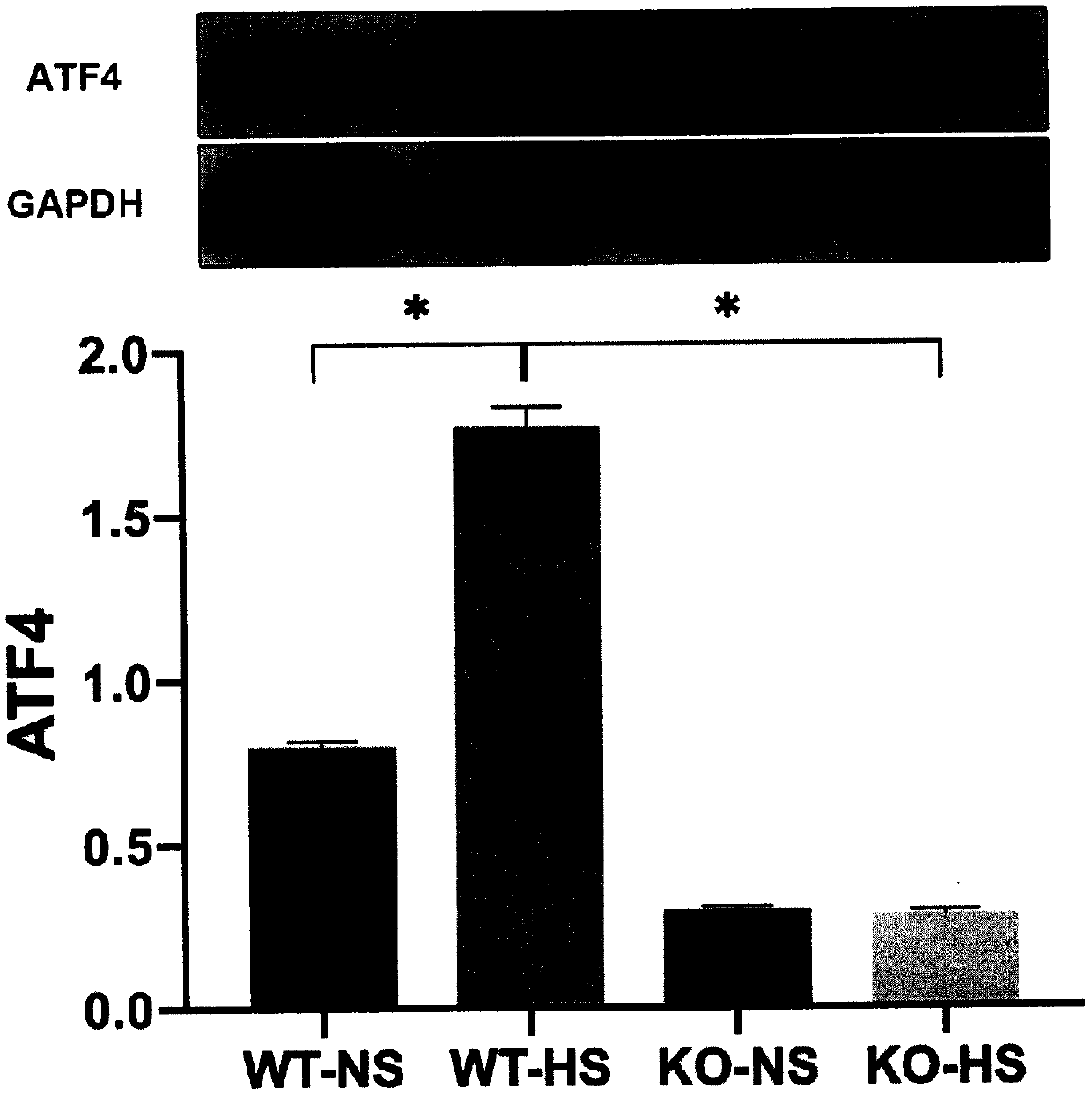 Gene-ATF4 capable of retarding blood pressure rise in high-salt induced mice