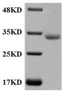 Recombinant beauveria brongniartii proteinase K mutant PK-M1 and preparation method thereof