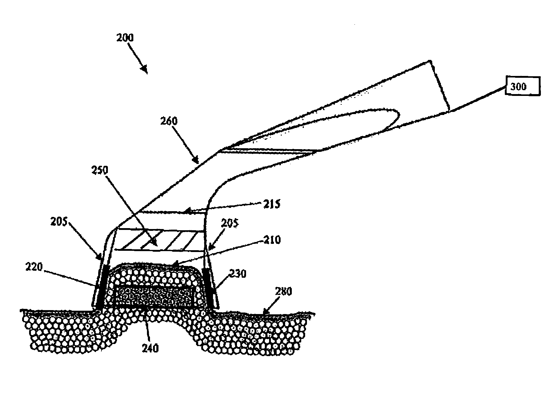 System and method for treating tissue