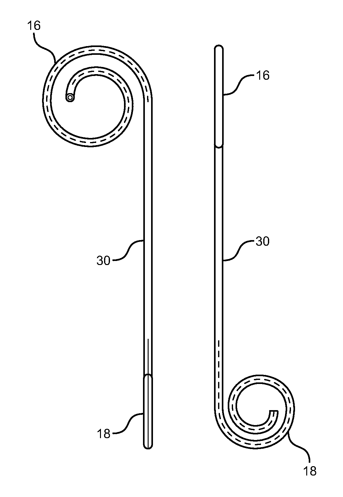 Anti-refluxive and trigone sparing internal ureteral stent