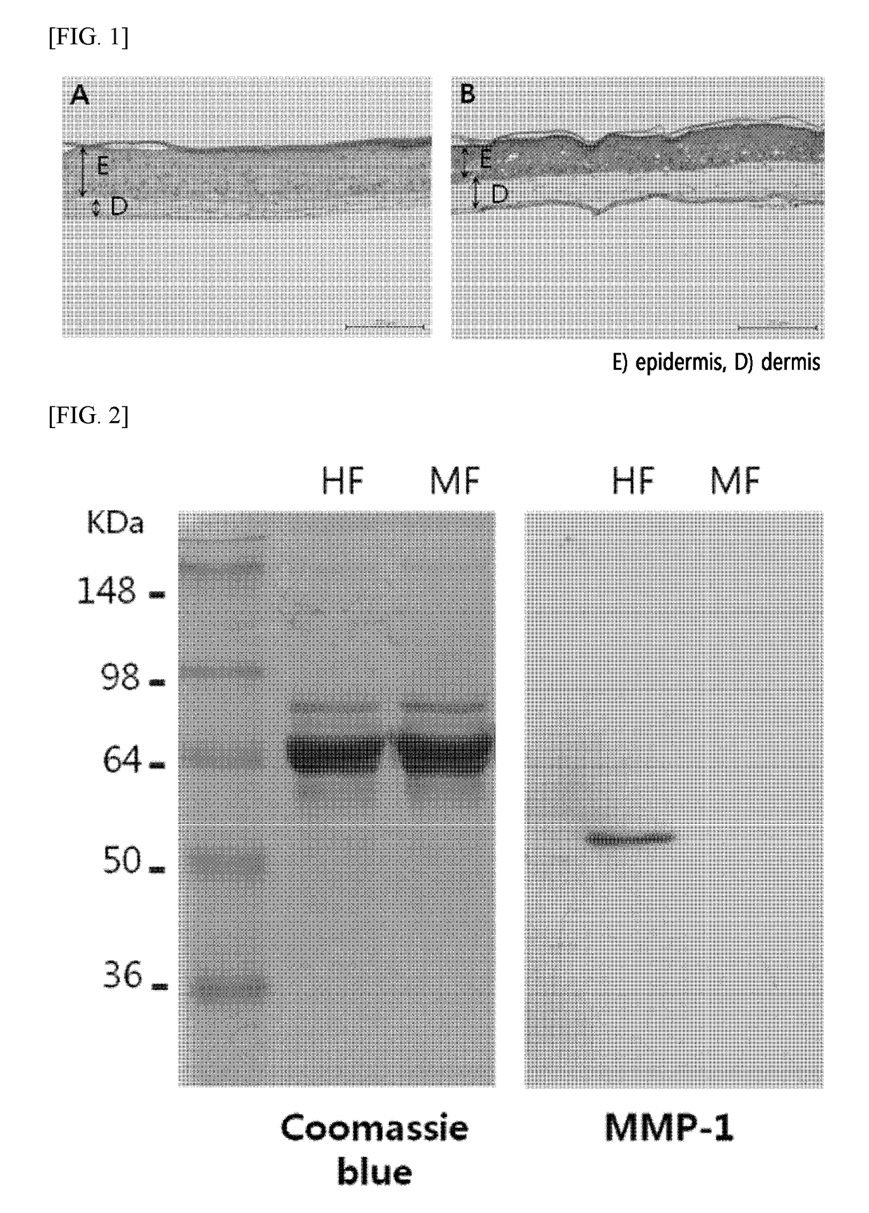 Method for preparing a three-dimensionally cultured skin comprising dermis and epidermis, and the cultured skin made therefrom