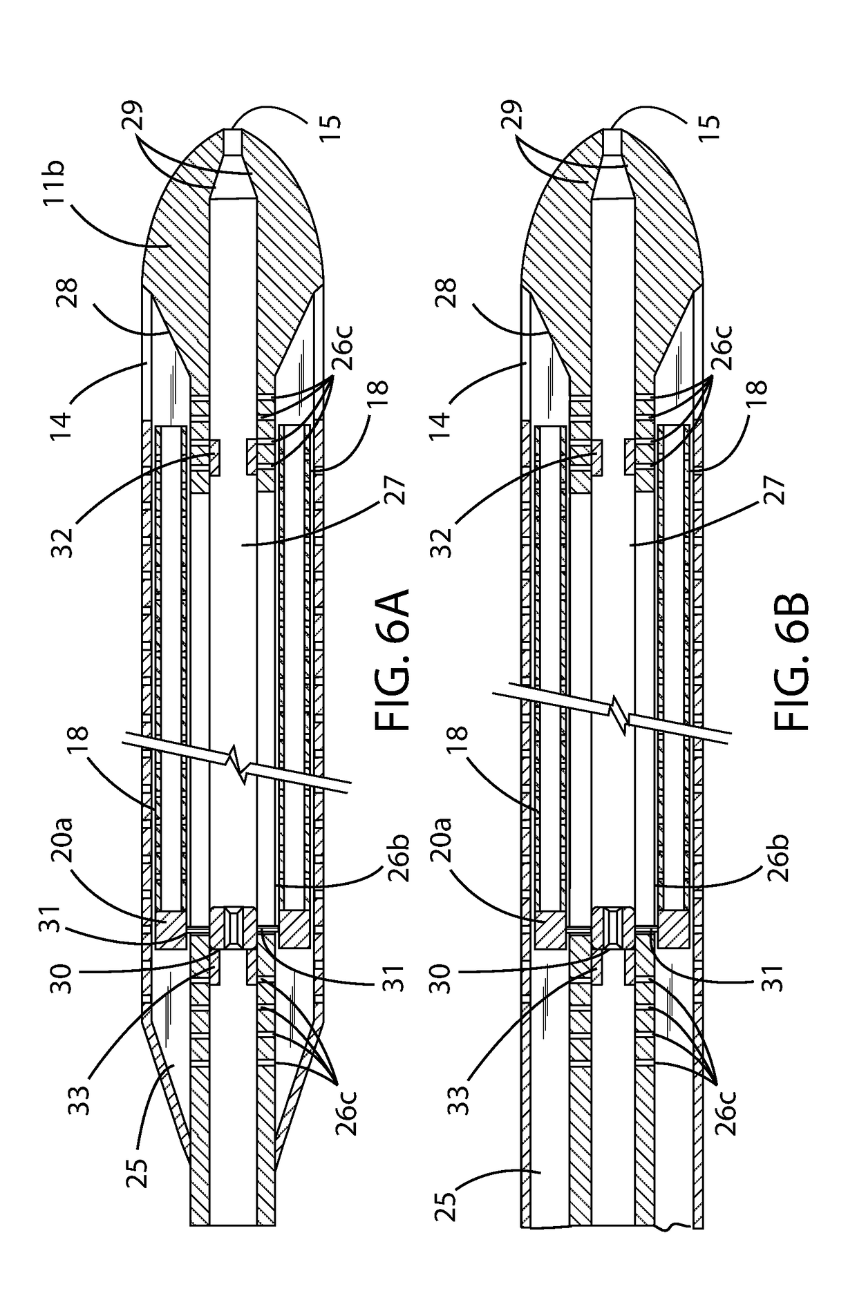 Drainage Catheter With Retractable Internal Drains