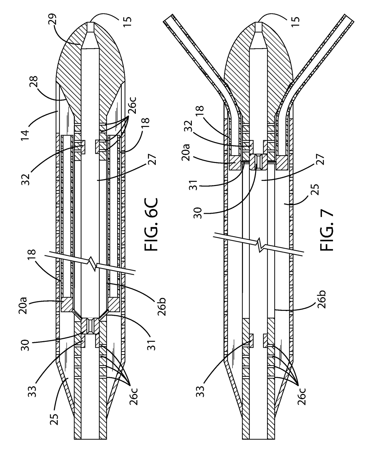 Drainage Catheter With Retractable Internal Drains