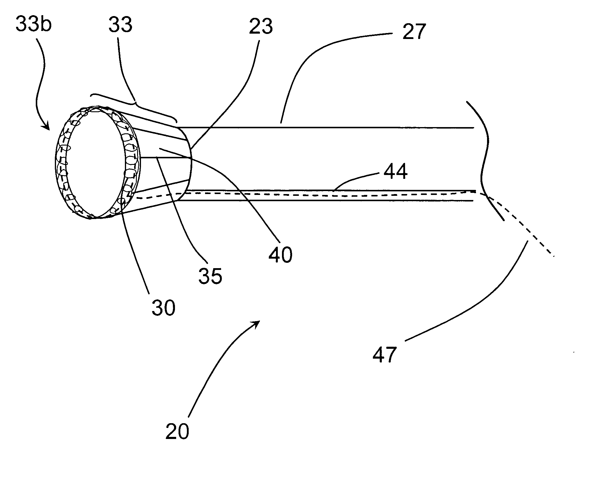 Funnel catheter device and method of operation thereof
