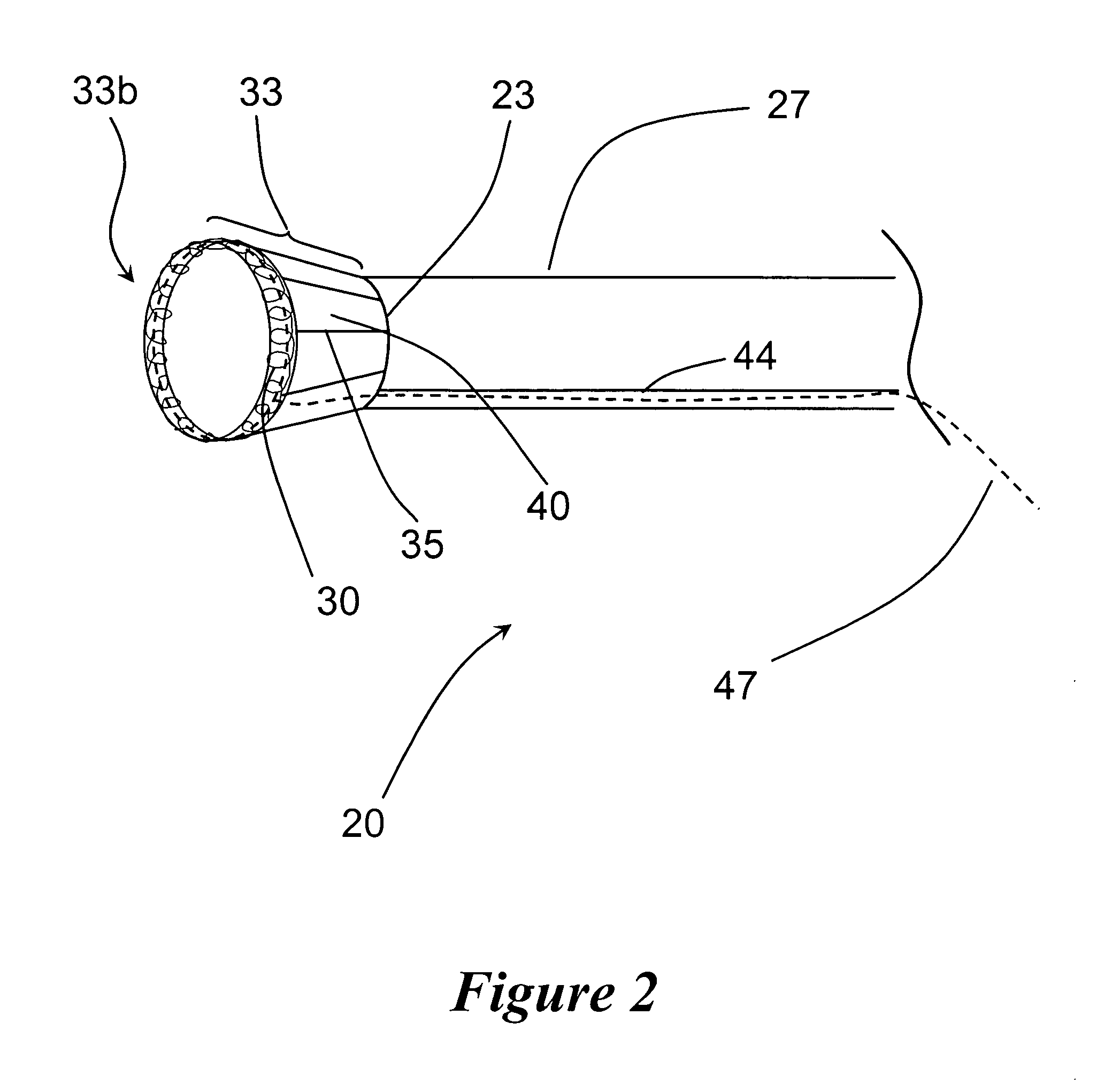 Funnel catheter device and method of operation thereof