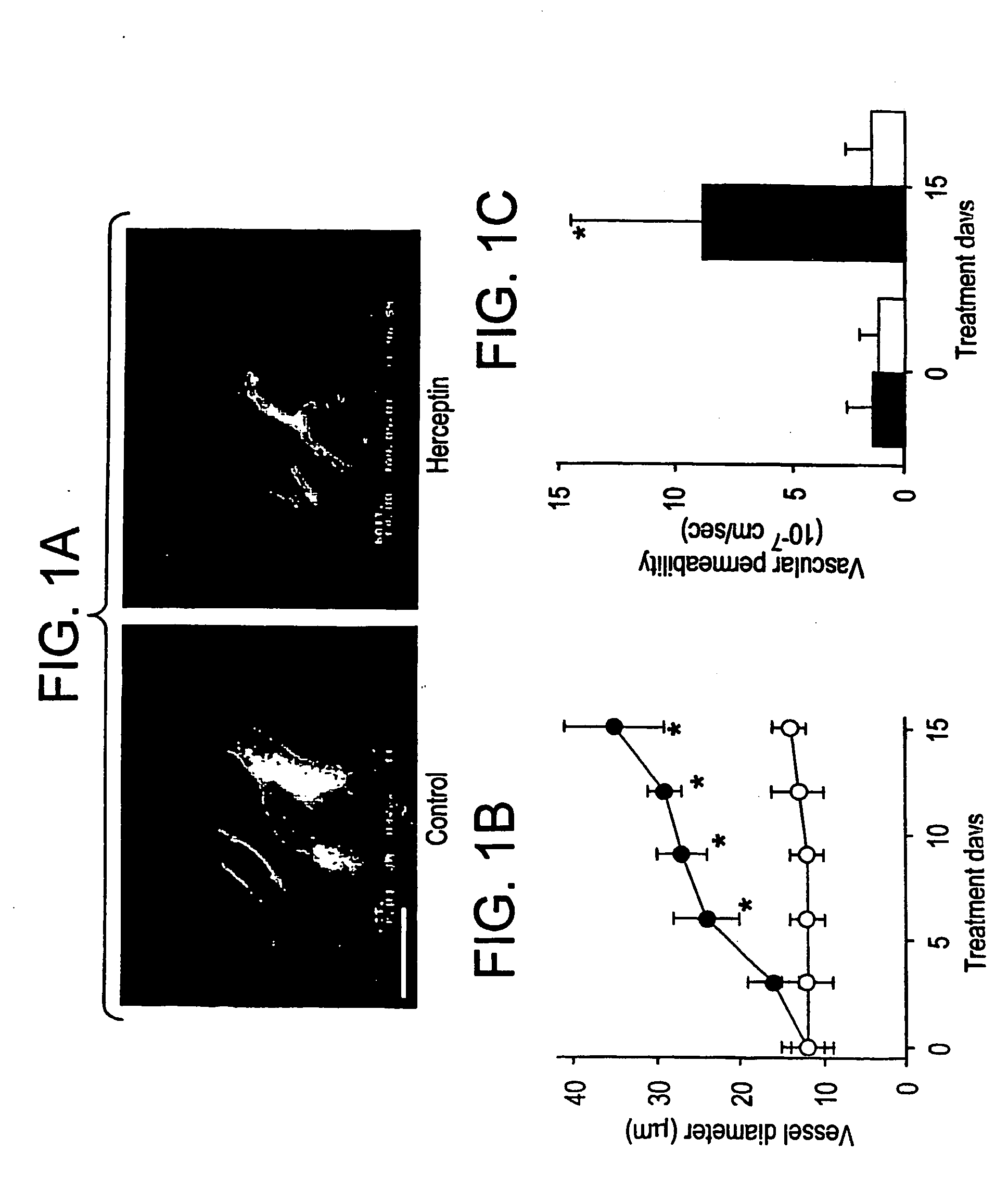 Use of signal transduction inhibitors and combination therapies for the prevention or treatment of cancer and angiogenesis related diseases