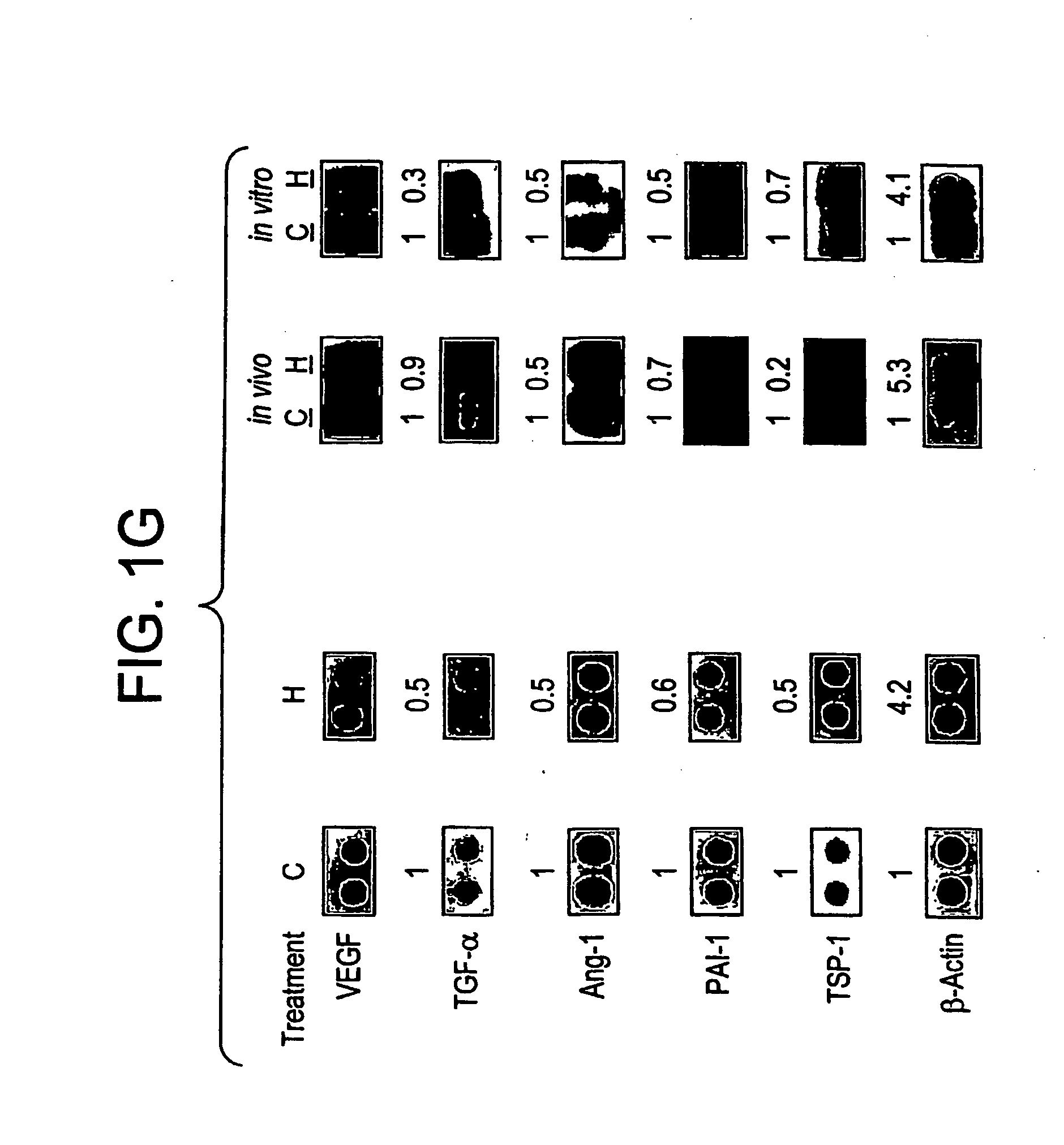 Use of signal transduction inhibitors and combination therapies for the prevention or treatment of cancer and angiogenesis related diseases