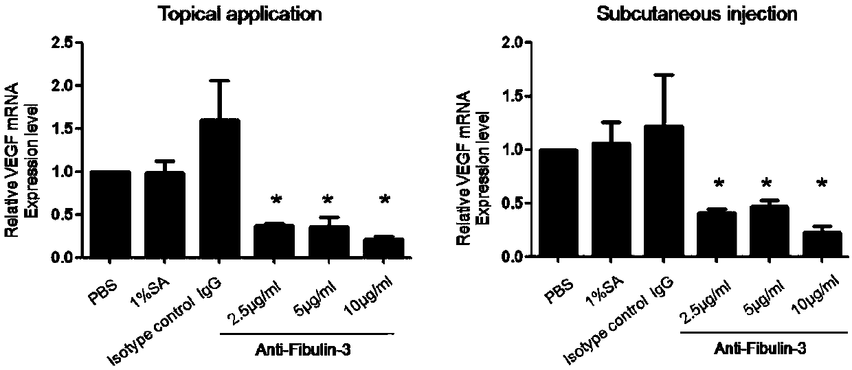 Application of Fibulin-3 taken as target point to prepare medicine for preventing and treating psoriasis