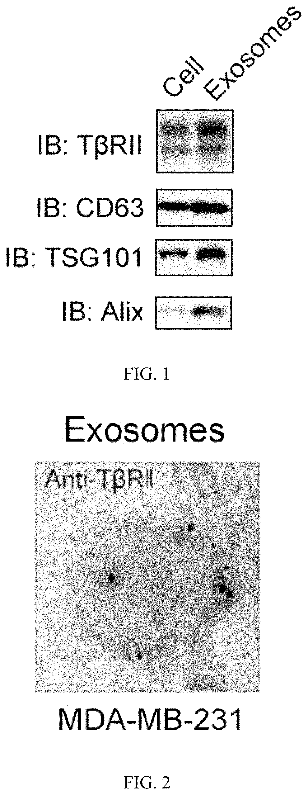 Application of exosome TβRII protein as a marker in the preparation of breast cancer detection kit