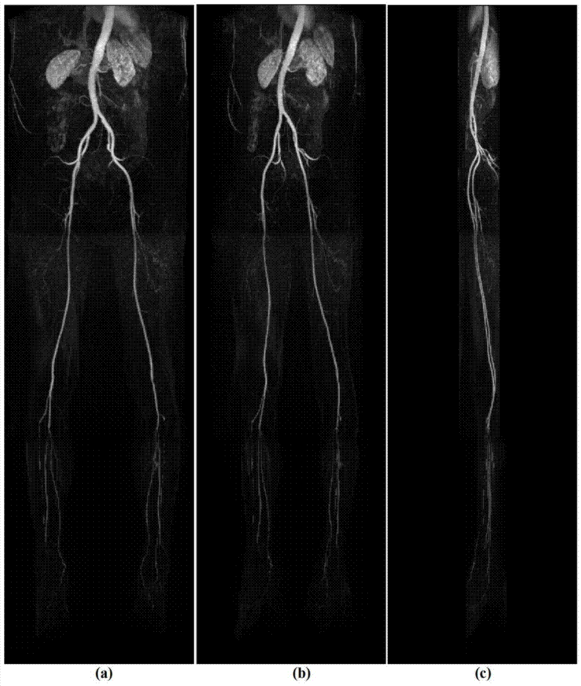 A Fast Registration and Stitching Method for 3D Digital Subtraction Angiography Images