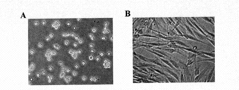 Method for preparing monocyte type stem cell and application